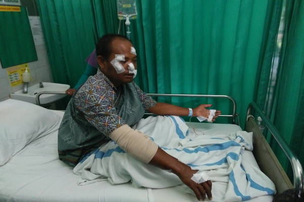 Cewek ABG Ikut Merampok Sopir Taksi, Ini Kronologinya