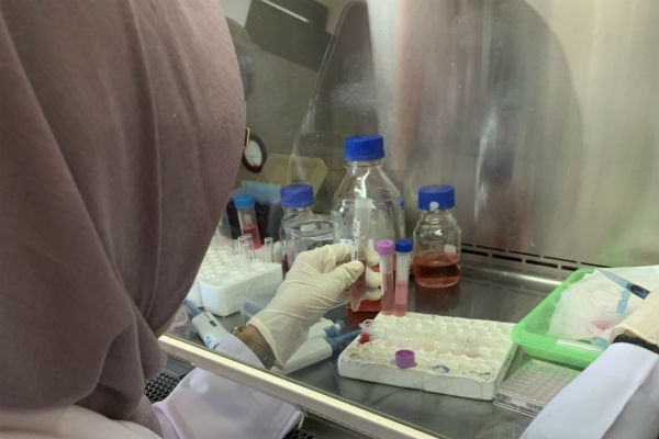  Mahasiswa UGM Teliti Telang Sebagai Obat Penghambat Sel Kanker