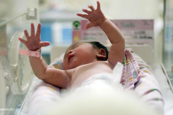 Tragis, Bayi dengan Banyak Kelainan Lahir di Buleleng, Seperti Ini Kondisinya