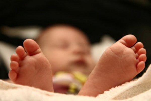Usus Besar Hanya Satu, Bayi Kembar Siam Dempet di Gunungkidul Tak Kunjung dipisahkan