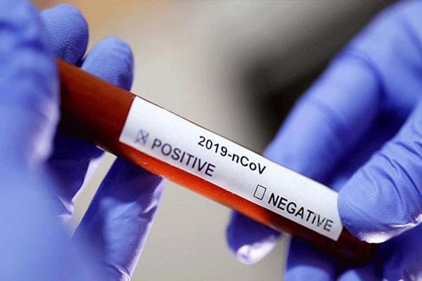 Corona, WHO Tingkatkan Level Persebaran Virus Corona Menjadi Sangat Tinggi