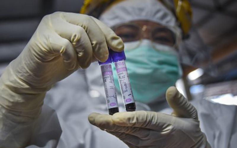 Guru Besar UGM Ciptakan Alat Rapid Test Virus Corona