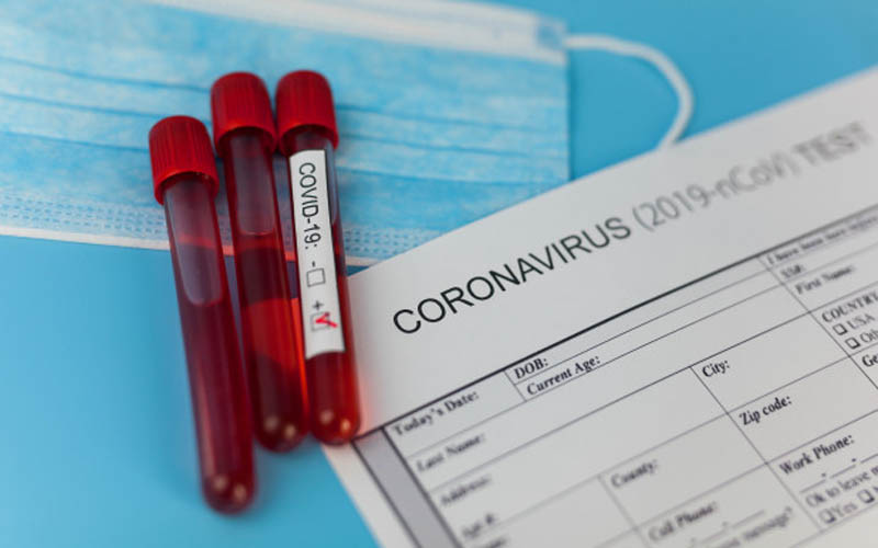 Penjelasan PT KAI tentang Syarat PCR/Swab atau Rapid Test untuk Penumpang Disanggah Warganet