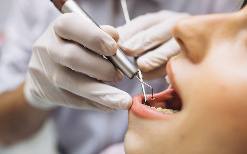 WHO Peringatkan Perawatan Gigi Tidak Mendesak Ditunda sampai Kasus Corona Reda