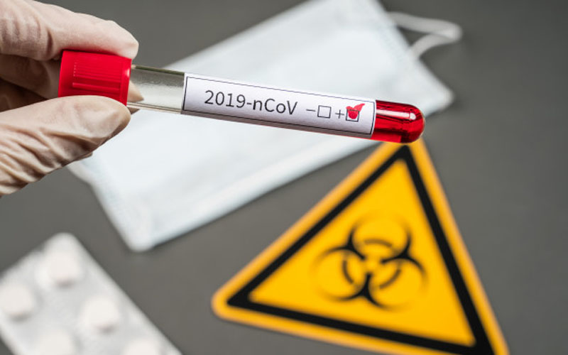 Rusia Mulai Produksi Vaksin Covid-19 & Akan Merilisnya Akhir Agustus