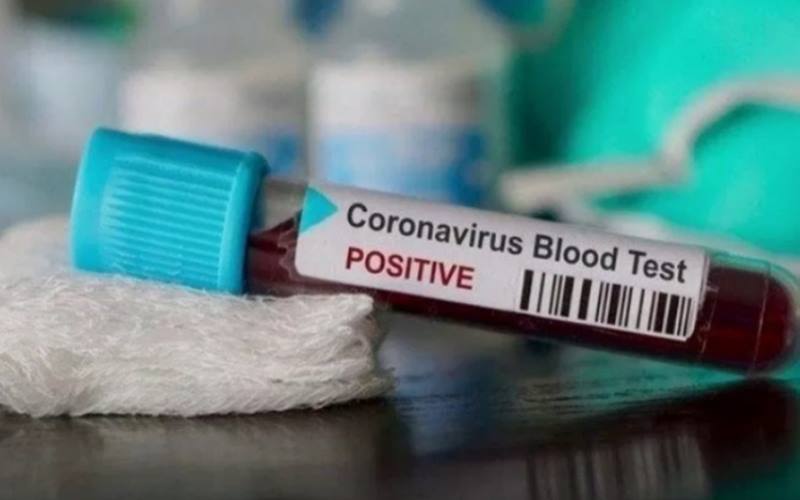 PENELITIAN: Tes Darah Dapat Memprediksi Peningkatan Risiko Kematian pada Pasien Covid-19
