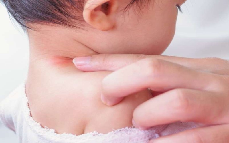 Jangan Anggap Sepele! Kenali Gejala Covid-19 pada Anak!
