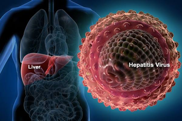 Kasus Hepatitis Langka dan Misterius Muncul di 12 Negara, 1 Anak Meninggal Dunia