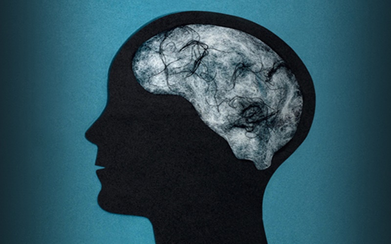 Beberapa Penyebab dan Gejala Pembekuan Darah di Otak, Bisa Sebabkan Stroke