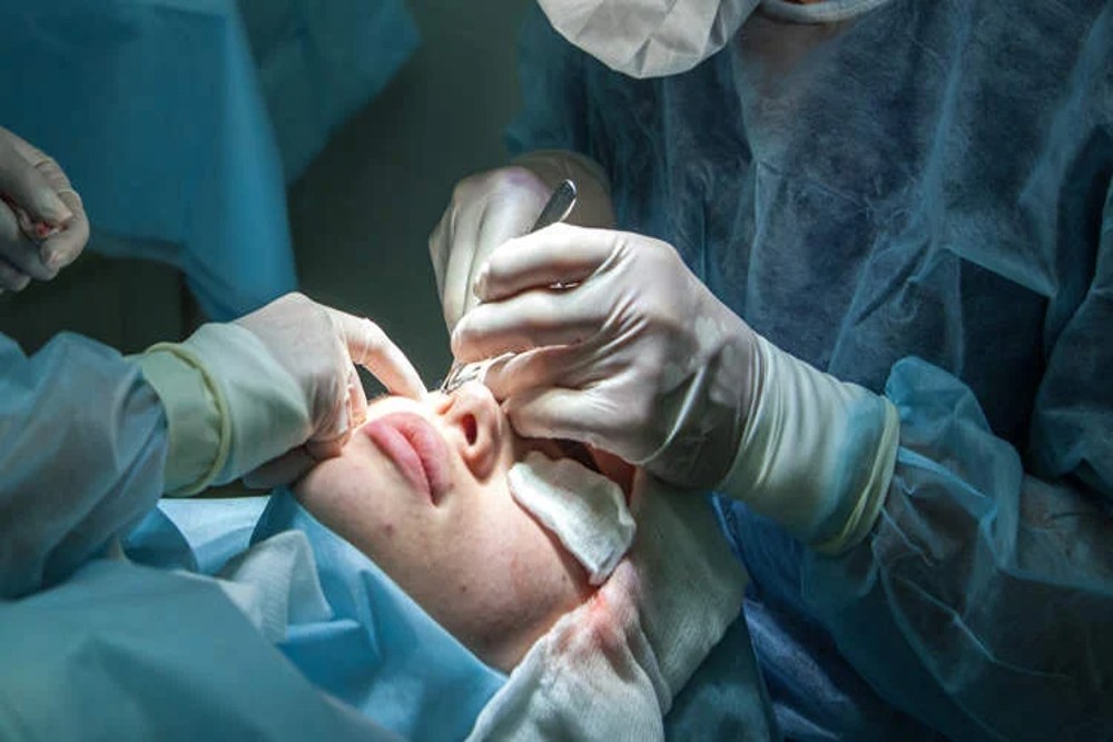 Astaga! Seorang Ibu Dikecam karena Dorong Putrinya yang Berusia 9 Tahun Operasi Plastik