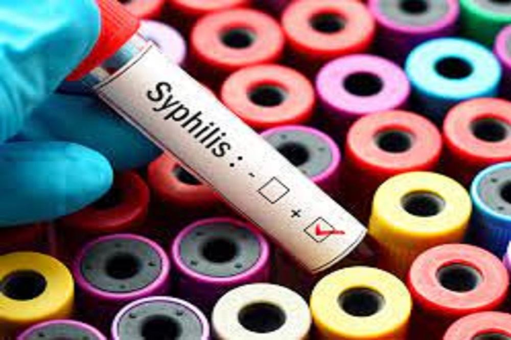 Pasien Sifilis di DIY Terus Melonjak, Terbanyak dari Kelompok Usia Ini