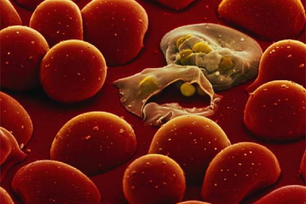12 Hal Tentang Penyakit Malaria yang Harus Diketahui