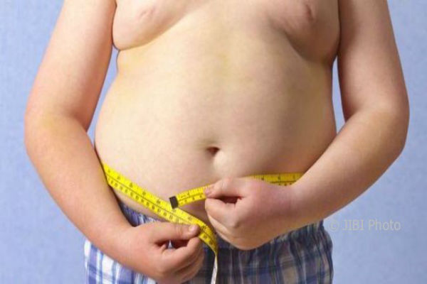 2.500 Anak SD di Kulonprogo Alami Obesitas