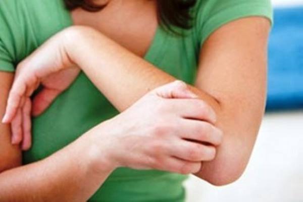 Serupa tapi Tak Sama, Perhatikan Perbedaa Alergi Susu Sapi dan Laktosa Intoleran