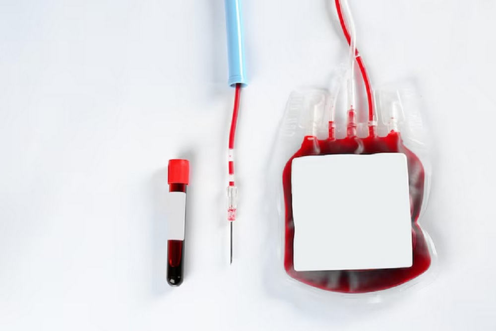 Stok Darah dan Jadwal Donor Darah di Wilayah DIY Kamis 18 April 2024