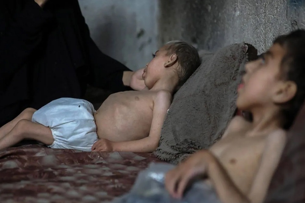 300 Anak Gaza yang Sakit Bakal Dievakuasi Pemerintah Inggris untuk Diobati