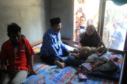 Menderita Tumor Kandung Kemih, Bocah 3 Tahun di Kulonprogo Sulit Bernapas