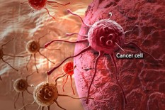 Ini 7 Gejala Kanker yang Sering Kali Diabaikan