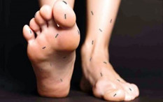 Sering Kesemutan Kaki dan Tangan? Waspadai Penyakit Ini