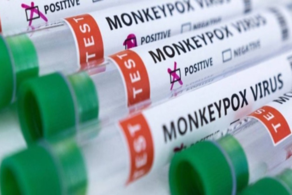 Hasil Tes PCR, Pasien Pertama Cacar Monyet Indonesia Dinyatakan Sembuh!