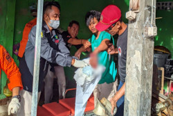 Bikin Bakso, Tangan Kiri Pria Ini Malah Ikut Masuk ke Mesin Penggilingan Daging