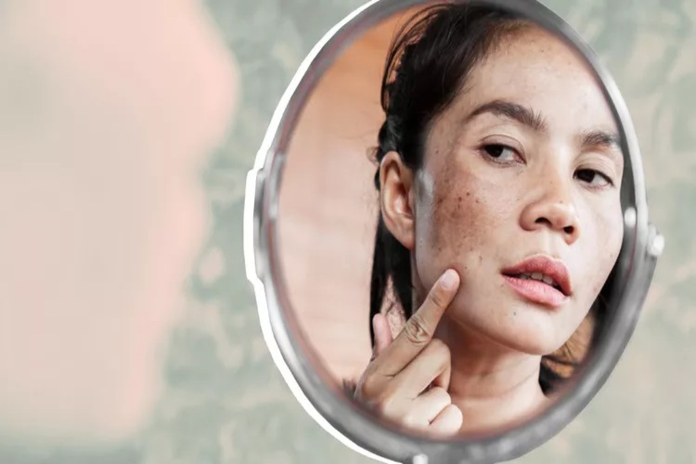 Mengenal 5 Ciri Skin Barrier yang Rusak pada Kulit Wajah