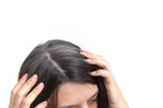 5 Minyak untuk Atasi Rambut Rontok hingga Ketombe