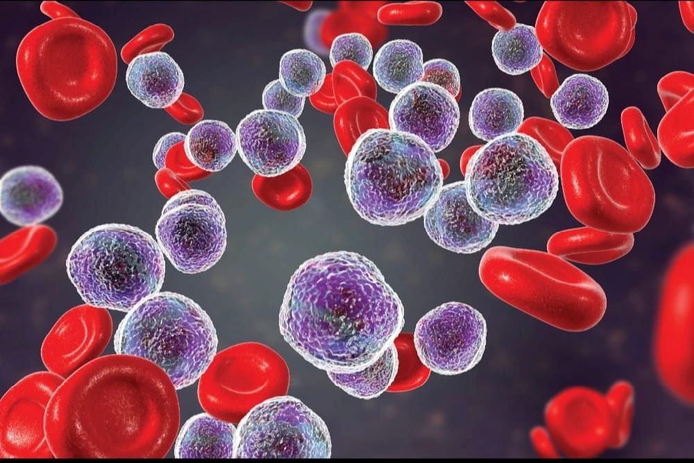 3 Metode Pengobatan Kanker Darah Terkini yang Diklaim Memberi Harapan Hidup Lebih Tinggi