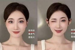 Telinga Peri yang Menonjol Jadi Tren Operasi Plastik di China, Dianggap Simbol Kecantikan