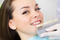 Memutihkan Gigi Memakai Veneer Masih Tren, Simak Potensi Masalah Gigi yang Bisa Muncul