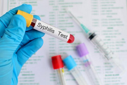 Kasus Sifilis di Bantul Melonjak hingga 97 Pasien di 2023