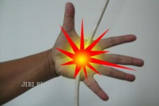 Tersengat Listrik, Warga Kotagede Jatuh dari Lantai 3