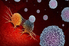 Dokter Spesialis Bedah Onkologi: Biopsi Jadi Kunci Pengobatan Kanker Payudara