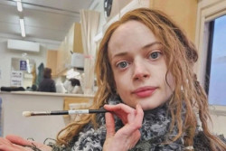 Aktris Ruth Codd Jalani Amputasi Lagi, Ini Ceritanya